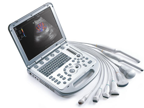Mindray M7 Laptop Based Ultrasound